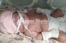 La beba mejora pero sus pap&aacute;s necesitan colaboraci&oacute;n.