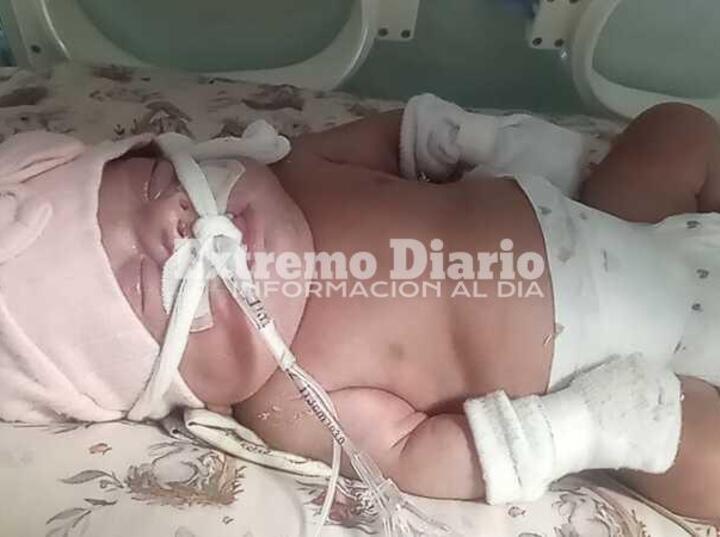 La beba mejora pero sus pap&aacute;s necesitan colaboraci&oacute;n.