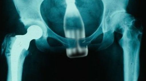 Imagen de Se duerme una siesta y le meten una botella en la cola