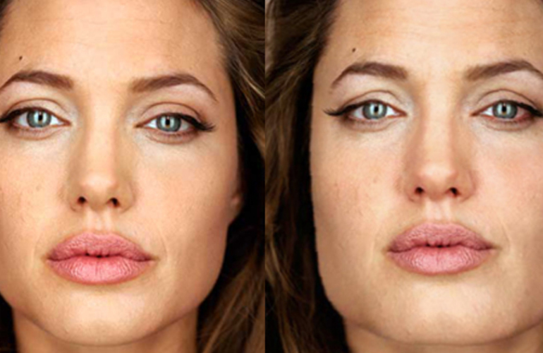 Imagen de &iquest;Mucho alcohol? C&oacute;mo te ver&aacute;s en 10 a&ntilde;os