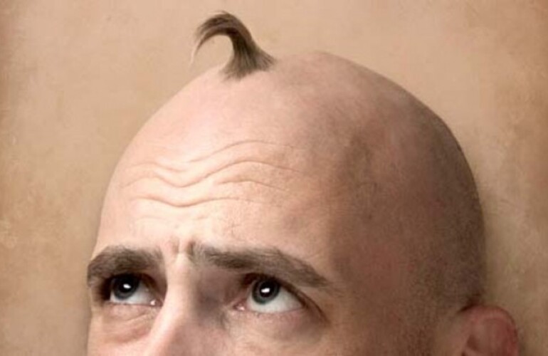 Imagen de Cient&iacute;ficos Argentinos crearon una "loci&oacute;n" contra la calvicie