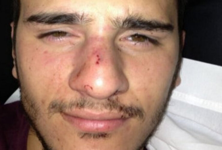 Imagen de Sufrió una brutal golpiza por ser homosexual Imagen de Sufrió una brutal golpiza por ser homosexual