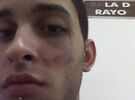 Imagen de Chicos denuncian golpiza dentro de un bar