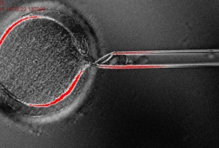 Imagen de Por primera vez, científicos convierten células humanas en células madre