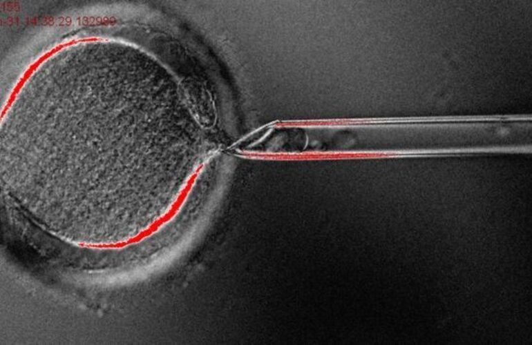 Imagen de Por primera vez, científicos convierten células humanas en células madre