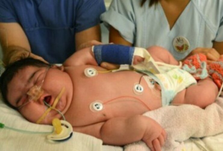 Imagen de Alemania: nació el bebé más grande del mundo