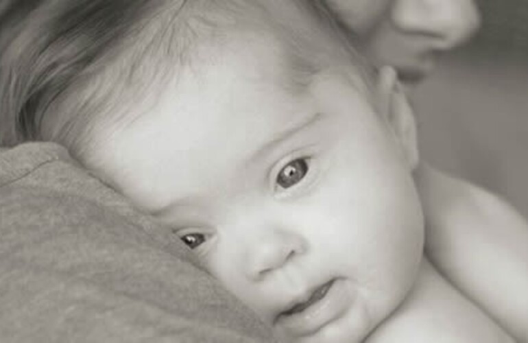 Imagen de Salud: test para detectar S&iacute;ndrome de Down