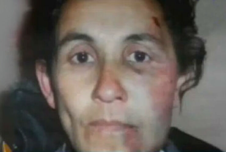Así quedó el rostro de la mujer tras la supuesta golpiza.
