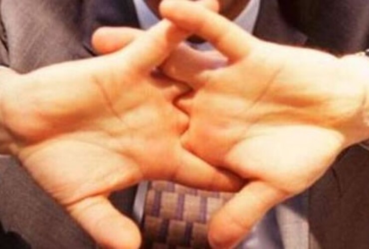 Imagen de Salud: ¿Crujirse los dedos da artritis?