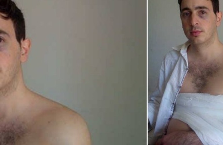 Nicol&aacute;s public&oacute; su foto en Facebook y m&aacute;s de 1500 personas compartieron el caso en horas. Foto: Facebook