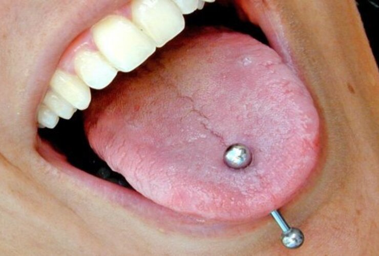 Imagen de Atención: Advierten que los piercings en la boca generan problemas al hablar