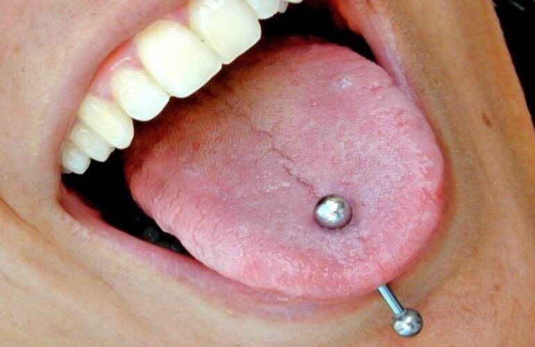 Imagen de Atención: Advierten que los piercings en la boca generan problemas al hablar