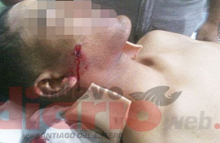 Imagen de Violencia escolar: Un alumno le dispar&oacute; en la cara a un compa&ntilde;ero de escuela