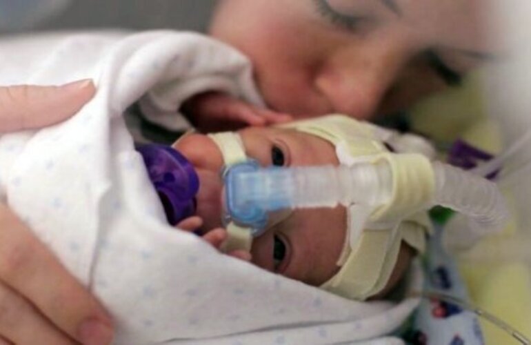 Imagen de El conmovedor video del beb&eacute; prematuro que recorre la web