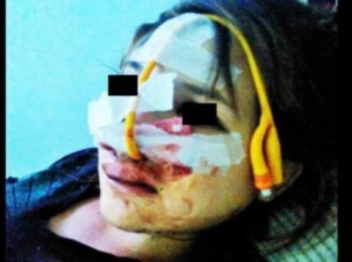 Imagen de Una joven de 16 años embarazada fue desfigurada por su novio por abrir una cuenta en Facebook