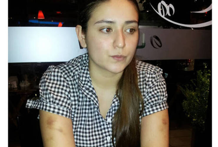 Marisa Mansilla, con las marcas de las agresiones que padeció.