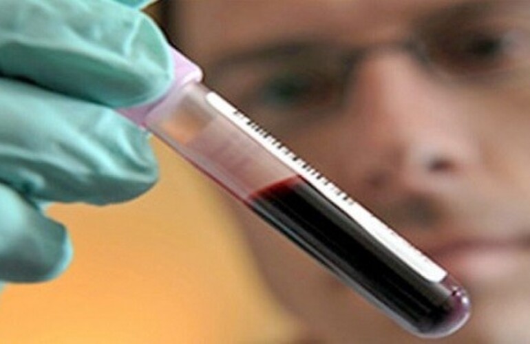 Imagen de La depresión podría detectarse mediante un análisis de sangre