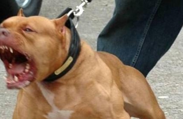 Imagen de Otro caso: Dos pitbull atacaron a un chico de 14 años