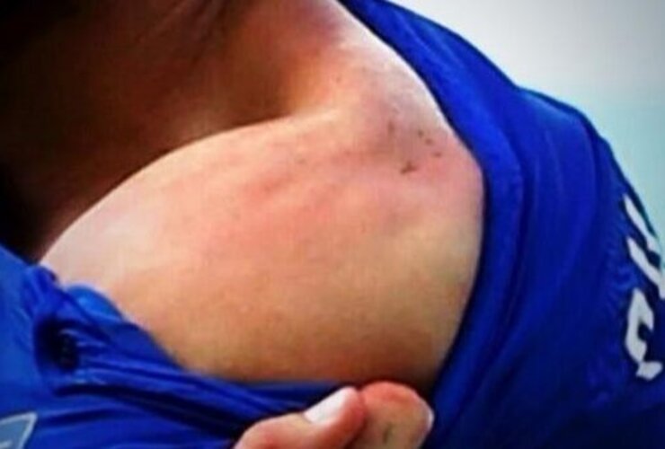 Imagen de El jugador italiano agredido bancó a Luis Suárez: "Fue excesiva la sanción"