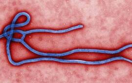 Así es el virus ébola. Foto: AP