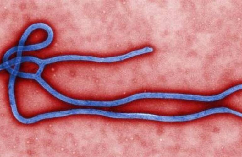Así es el virus ébola. Foto: AP