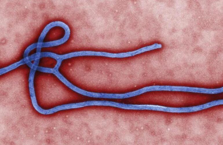 Imagen de ¿Habrá una vacuna en 2015 contra el Ébola?