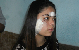 Imagen de Una joven fue atacada por otra que le cortó la cara