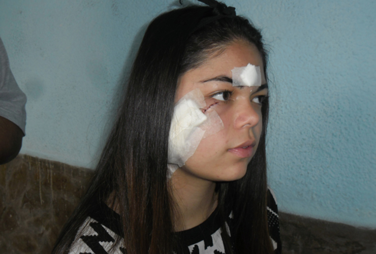 Imagen de Una joven fue atacada por otra que le cortó la cara