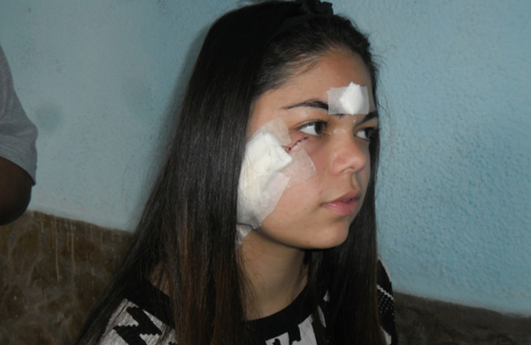 Imagen de Una joven fue atacada por otra que le cortó la cara
