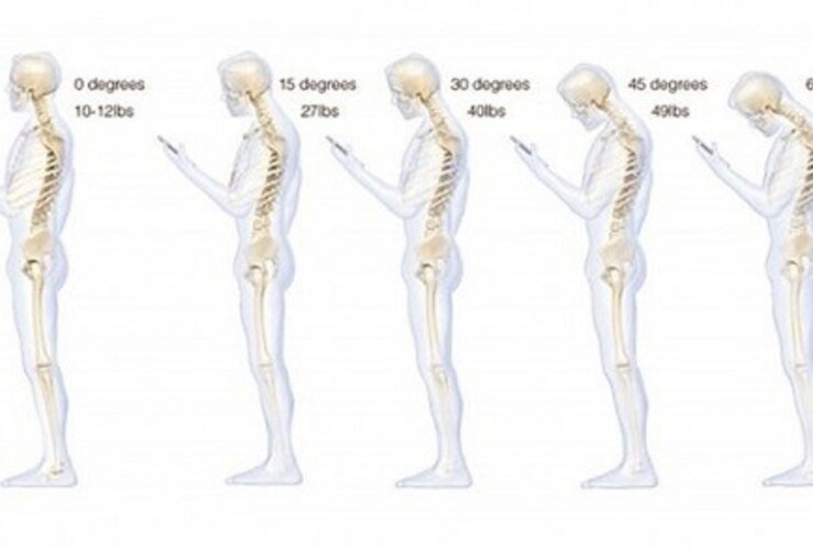 Imagen de Mirar el celular trae problemas en la columna