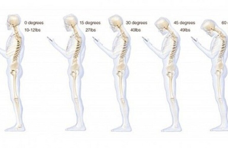 Imagen de Mirar el celular trae problemas en la columna