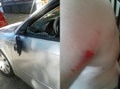 Imagen de Agredieron a golpes a Luis Yorlano durante una discusión de tránsito