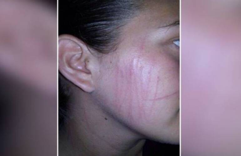 Mar&iacute;a Fernanda Ledesma