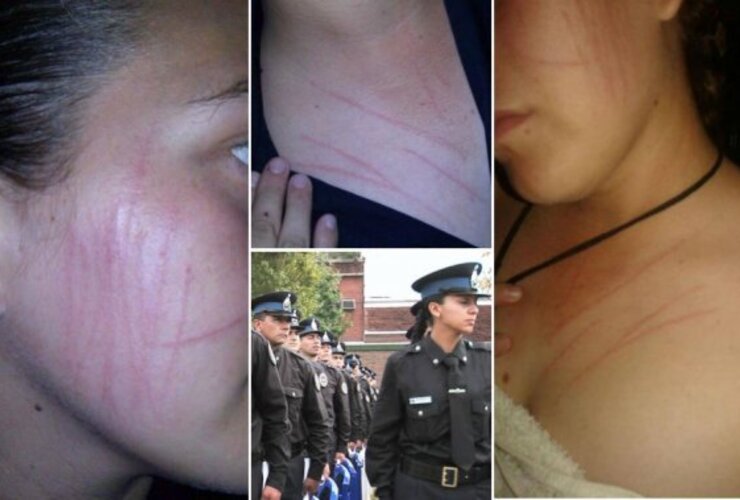 Las marcas de los "ataques fantasmas" Las marcas de los "ataques fantasmas"