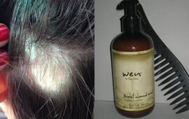 Denuncian a un estilista por vender un shampoo que provoca la caída del cabello