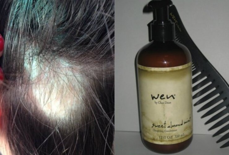 Denuncian a un estilista por vender un shampoo que provoca la caída del cabello