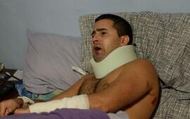 Marcelo se recuperaba ayer en su casa. Le pegaron en la boca, el cuello, la cabeza y la espalda. Asegura que el agresor estaba sacado.