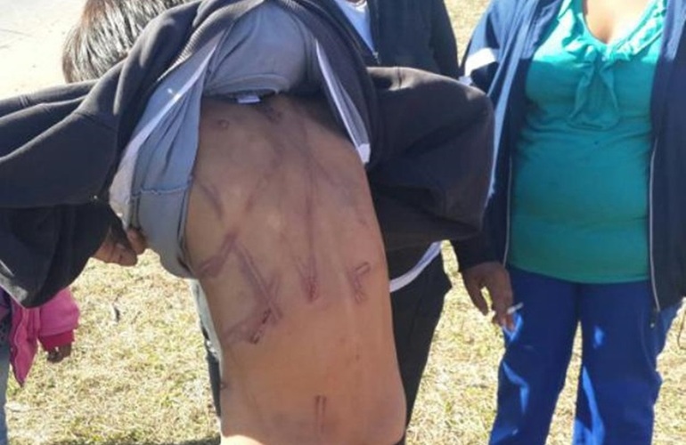 Marcado. El agresor se vali&oacute; de un cable para dar latigazos a los hijos.