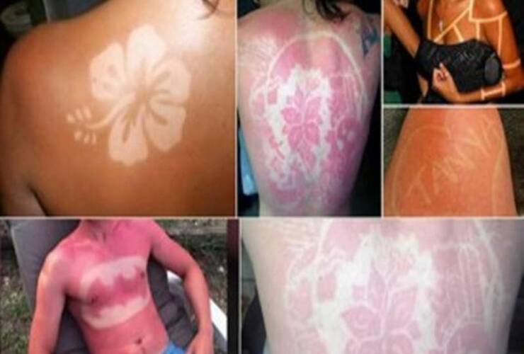 Moda peligrosa. La tendencia es furor en el hemisferio norte