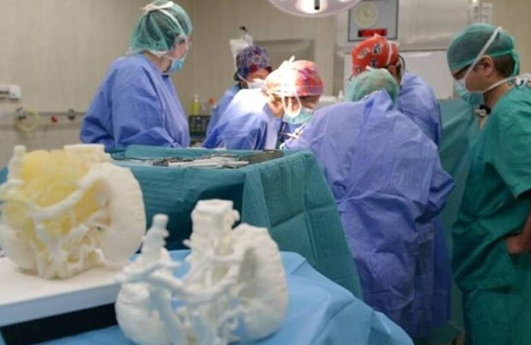 Las t&eacute;cnicas 3D se usan cada vez m&aacute;s en cirug&iacute;as complejas a nivel mundial. Foto: Hospital Sant Joan de D&eacute;u de Barcelona