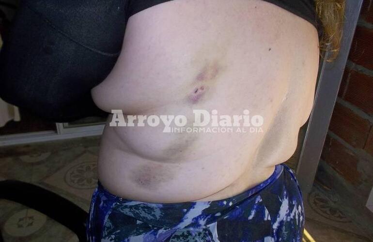 Las marcas todavía en el cuerpo de la víctima.