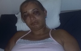 Lorena se recupera de los dolores f&iacute;sicos y del alma. Foto: Facebook