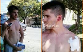 Imagen de Golpes de puño y mordida tras accidente de tránsito