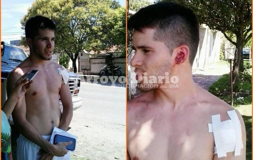 Imagen de Golpes de pu&ntilde;o y mordida tras accidente de tr&aacute;nsito