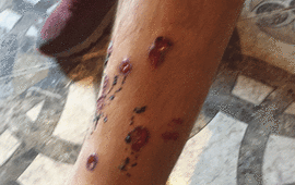 Imagen de Condenan a Ema Pimpi por el ataque al ex gobernador