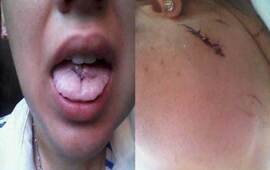 Imagen de Apu&ntilde;al&oacute; a su novia hasta casi matarla y s&oacute;lo estuvo preso dos horas