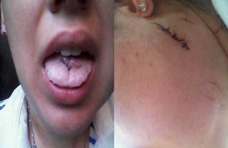 Imagen de Apu&ntilde;al&oacute; a su novia hasta casi matarla y s&oacute;lo estuvo preso dos horas