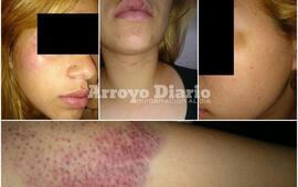 Imagen de Violencia de género: "Él me hizo mucho daño"