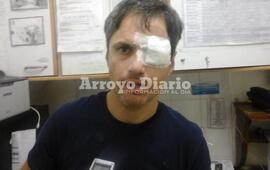 Sergio Brollo comentó que ya le habían robado otras veces pero nunca con tanta violencia.