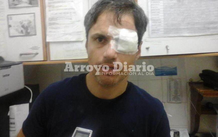 Sergio Brollo coment&oacute; que ya le hab&iacute;an robado otras veces pero nunca con tanta violencia.